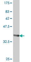 Anti-POLR1B Mouse Polyclonal Antibody