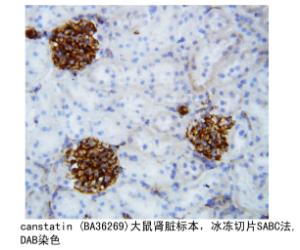 Anti-Collagen IV Rabbit Polyclonal Antibody