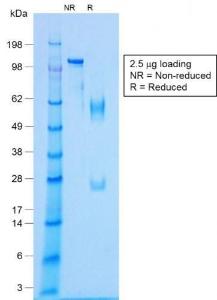 Anti-NKX2.2 Rabbit Recombinant Antibody [clone: NX2/1422R]