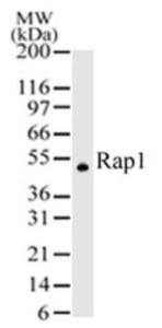 Anti-TERF21P Rabbit Polyclonal Antibody