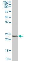 Anti-DTYMK Mouse Polyclonal Antibody