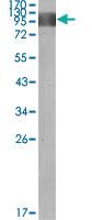 Anti-FLT1 Mouse Monoclonal Antibody [clone: 3D10]