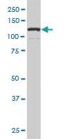 Anti-DAAM1 Mouse Monoclonal Antibody [clone: 5D3]