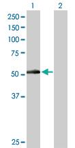 Anti-PNPLA3 Rabbit Polyclonal Antibody