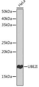 Anti-UBE2I/UBC9 Rabbit Monoclonal Antibody [clone: ARC0996]