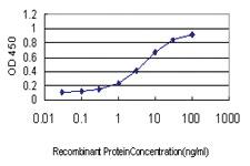 Anti-BDKRB2 Mouse Monoclonal Antibody [clone: 3F6]