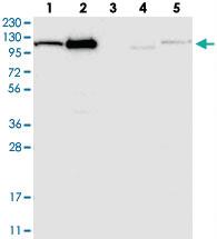 Anti-AASS Rabbit Polyclonal Antibody