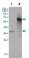 Anti-NCOA3 Mouse Monoclonal Antibody [clone: 2C11B12]