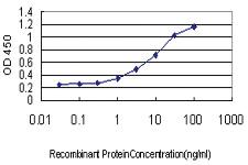 Anti-RABL6 Mouse Monoclonal Antibody [clone: 2E11-1F10]