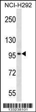 Anti-MID2 Rabbit Polyclonal Antibody (HRP (Horseradish Peroxidase))