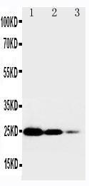 Anti-TNF Receptor I Rabbit Polyclonal Antibody