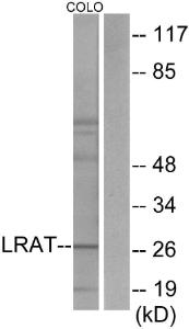 Anti-LRAT Rabbit Polyclonal Antibody