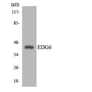 Western blot analysis of the lysates from HT 29 cells using Anti-EDG6 Antibody