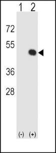 Anti-HLA Class 1 Antigen E Rabbit Polyclonal Antibody (APC (Allophycocyanin))