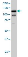 Anti-DAAM1 Mouse Monoclonal Antibody [clone: 5D3]