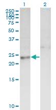 Anti-DTYMK Mouse Monoclonal Antibody [clone: 2C2]