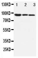 Anti-beta Catenin Rabbit Polyclonal Antibody