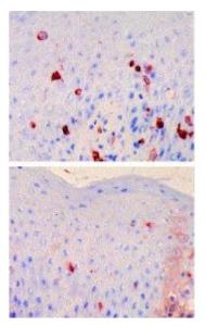 Anti-FCER1A Antibody