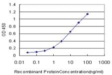 Anti-EPM2AIP1 Mouse Monoclonal Antibody [clone: 3H7]