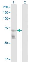 Anti-GATAD2B Rabbit Polyclonal Antibody