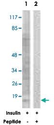 Anti-EIF4EBP1 Rabbit Polyclonal Antibody