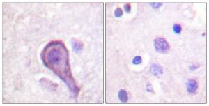 Antibody anti-rhodopsin 100 µg