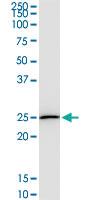 Anti-DTYMK Mouse Monoclonal Antibody [clone: 2G11]