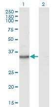 Anti-KYNU Mouse Monoclonal Antibody [clone: 1G2]