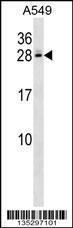 Anti-C4BPB Rabbit Polyclonal Antibody (HRP (Horseradish Peroxidase))