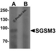 Western blot analysis of SGSM3 in 293 cell lysate with SGSM3 antibody at 1 &#956;g/mL in (A) the absence and (B) the presence of blocking peptide.