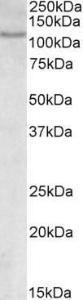 Anti-NFATC2 Antibody (A83024) (0.3µg/ml) staining of MOLT4 lysate (35µg protein in RIPA buffer). Primary incubation was 1 hour. Detected by chemiluminescence.