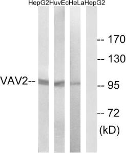 Western blot analysis of lysates from HepG HUVEC, and HeLa cells using Anti-VAV2 Antibody. The right hand lane represents a negative control, where the antibody is blocked by the immunising peptide