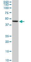 Anti-PNPLA3 Rabbit Polyclonal Antibody