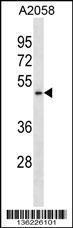 Anti-BFAR Rabbit Polyclonal Antibody (FITC (Fluorescein Isothiocyanate))