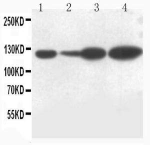 Anti-Notch1 Rabbit Polyclonal Antibody