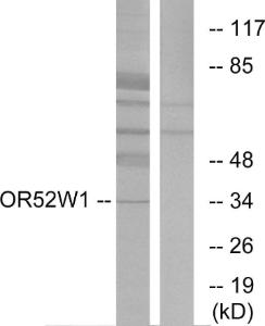 Western blot analysis of lysates from HeLa cells using Anti-OR52W1 Antibody. The right hand lane represents a negative control, where the antibody is blocked by the immunising peptide.