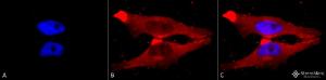 Immunocytochemistry/Immunofluorescence analysis of human heat shocked cervical cancer cell line (HeLa), fixed in 2% formaldehyde for 20 minutes at room temperature, using Anti-PUMA Antibody (A304946), at 1:125 for 12 hours at 4°C