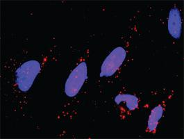 Anti-DUSP1 Mouse Monoclonal Antibody [clone: 4H7]