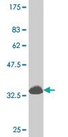 Anti-DLX1 Mouse Monoclonal Antibody [clone: 4B7]