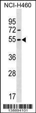 Anti-MIER1 Rabbit Polyclonal Antibody (HRP (Horseradish Peroxidase))