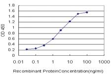 Anti-KYNU Mouse Monoclonal Antibody [clone: 1G2]