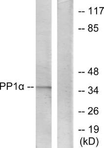 Western blot analysis of lysates from Jurkat cells using Anti-PP1-alpha Antibody. The right hand lane represents a negative control, where the antibody is blocked by the immunising peptide