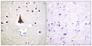 Immunohistochemical analysis of paraffin-embedded human brain tissue using Anti-VAV2 Antibody. The right hand panel represents a negative control, where the antibody was pre-incubated with the immunising peptide