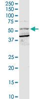 Anti-BTRC Rabbit Polyclonal Antibody