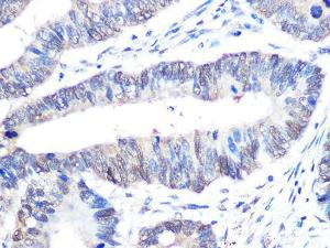 Anti-UBE2I/UBC9 Rabbit Monoclonal Antibody [clone: ARC0996]