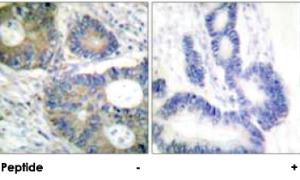 Anti-EIF4EBP1 Rabbit Polyclonal Antibody