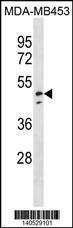 Anti-NDUFV1 Rabbit Polyclonal Antibody (HRP (Horseradish Peroxidase))