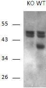 Anti-RCAN1 antibody