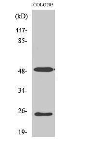 Anti-LRAT Rabbit Polyclonal Antibody