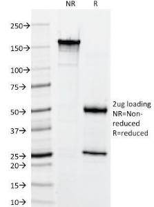 SDS-PAGE analysis of Anti-Keratin 76 Antibody [34BE12] under non-reduced and reduced conditions; showing intact IgG and intact heavy and light chains, respectively. SDS-PAGE analysis confirms the integrity and purity of the Antibody